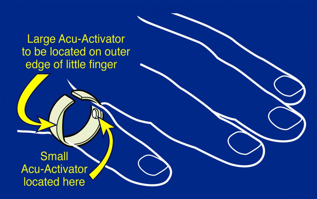 Good Night Anti-Snoring Ring Placement Diagram