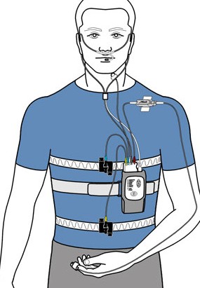 sleep apnea testing device