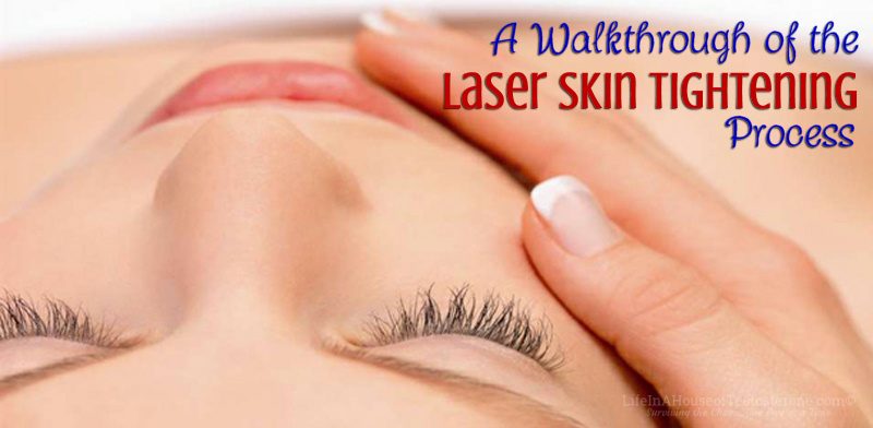 A Walkthrough of the Laser Skin Tightening Process