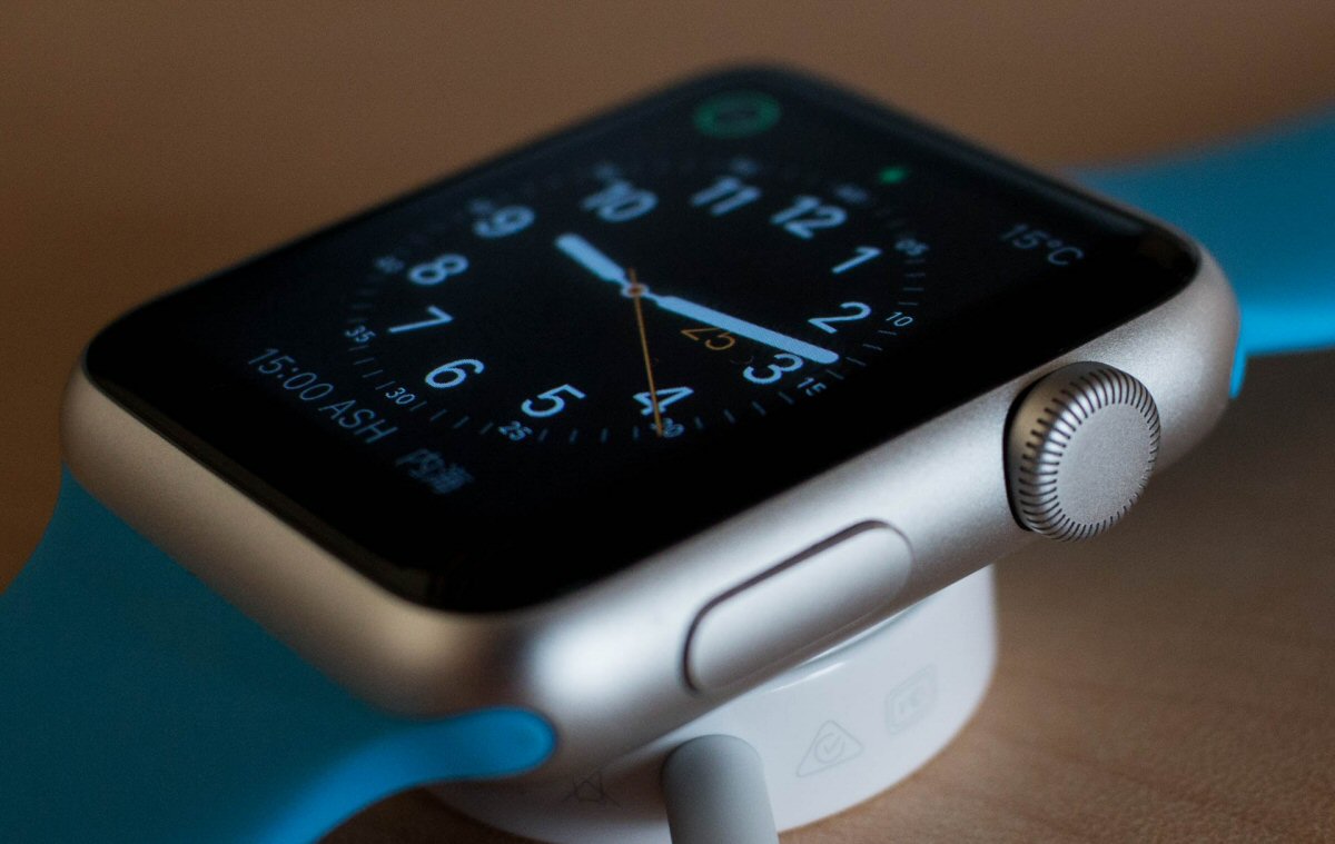 The Apple Watch - Is It Worth the Money?